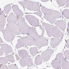 Immunohistochemical staining of human skeletal muscle shows very weak cytoplasmic granular positivity in myocytes.
