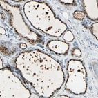 Immunohistochemical staining of human thyroid gland shows strong cytoplasmic positivity in glandular cells.