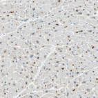 Immunohistochemical staining of human heart muscle shows strong cytoplasmic positivity in cardiomyocytes.