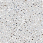 Immunohistochemical staining of human heart muscle shows strong cytoplasmic positivity in cardiomyocytes.