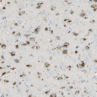 Immunohistochemical staining of human cerebral cortex shows strong cytoplasmic positivity in neurons.