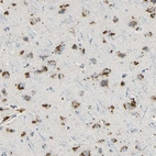 Immunohistochemical staining of human cerebral cortex shows strong cytoplasmic positivity in neurons.