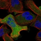 Anti-ANXA6 Antibody