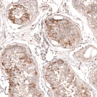 Anti-MTM1 Antibody