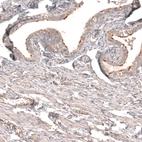Immunohistochemical staining of human fallopian tube shows moderate to strong membranous positivity in subsets of glandular cells.