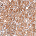 Immunohistochemical staining of human kidney shows moderate to strong cytoplasmic positivity in cells in tubules.