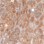 Immunohistochemical staining of human kidney shows moderate to strong cytoplasmic positivity in cells in tubules.