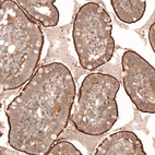 Immunohistochemical staining of human small intestine shows moderate to strong membranous positivity in glandular cells.