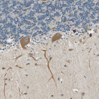 Immunohistochemical staining of human cerebellum shows moderate cytoplasmic positivity in Purkinje cells.