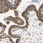 Immunohistochemical staining of human placenta shows moderate cytoplasmic positivity in trophoblastic cells.