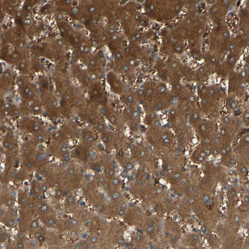 Anti-C1orf159 Antibody
