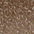 Anti-C1orf159 Antibody