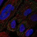 Anti-COL12A1 Antibody