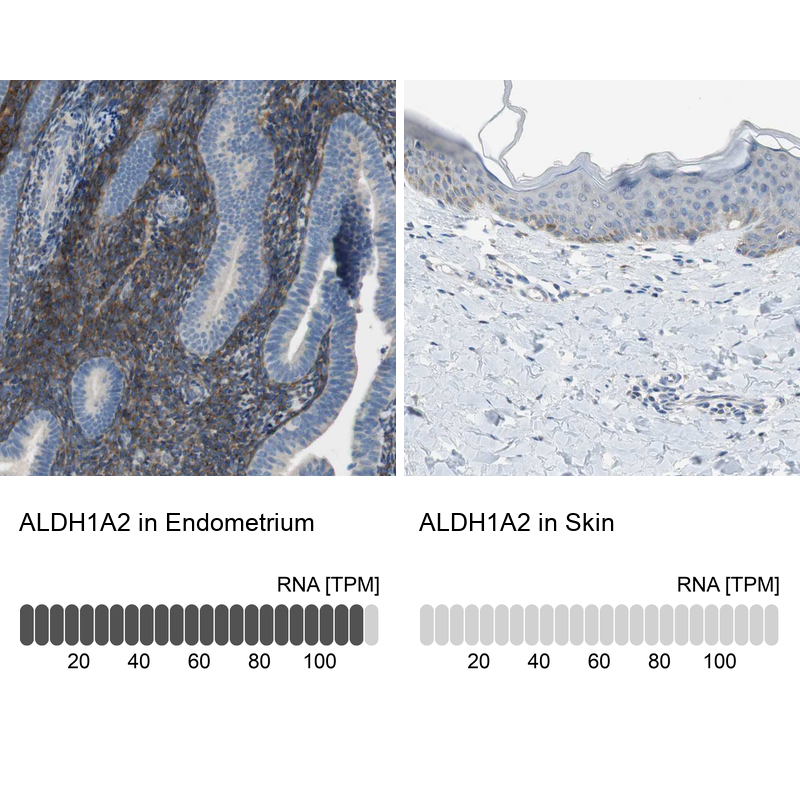 Anti-ALDH1A2 Antibody