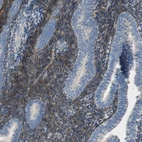 Immunohistochemical staining of human endometrium shows moderate to strong cytoplasmic positivity in cells in endometrial stroma.