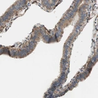 Immunohistochemical staining of human fallopian tube shows moderate to strong cytoplasmic positivity in glandular cells.