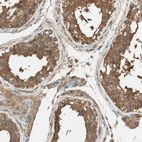 Immunohistochemical staining of human testis shows moderate to strong cytoplasmic positivity in cells in seminiferous ducts.