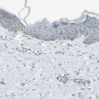 Anti-ALDH1A2 Antibody