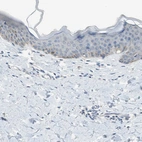 Immunohistochemical staining of human skin shows weak cytoplasmic positivity in a subset of keratinocytes.