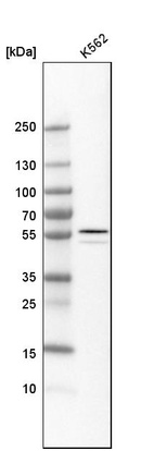 Anti-ALDH1A2 Antibody