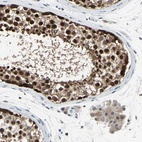 Anti-HSPA4 Antibody
