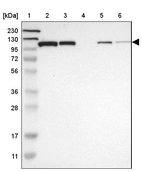 Lane 1: Marker [kDa] 230, 130, 95, 72, 56, 36, 28, 17, 11_br/_Lane 2: Human cell line RT-4_br/_Lane 3: Human cell line U-251MG sp_br/_Lane 4: Human plasma (IgG/HSA depleted)_br/_Lane 5: Human liver tissue_br/_Lane 6: Human tonsil tissue