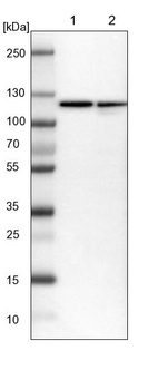 Lane 1: NIH-3T3 cell lysate (Mouse embryonic fibroblast cells)_br/_Lane 2: NBT-II cell lysate (Rat Wistar bladder tumour cells)