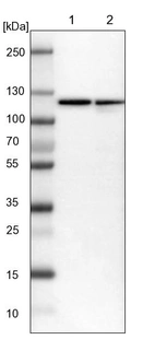 Lane 1: NIH-3T3 cell lysate (Mouse embryonic fibroblast cells)_br/_Lane 2: NBT-II cell lysate (Rat Wistar bladder tumour cells)