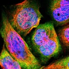 Immunofluorescent staining of human cell line A-431 shows localization to nucleoplasm & cytosol.