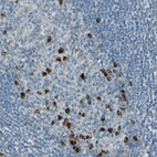 Immunohistochemical staining of human tonsil shows strong cytoplasmic positivity in a small subset of germinal center cells.