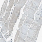 Immunohistochemical staining of human skeletal muscle shows no positivity in myocytes as expected.