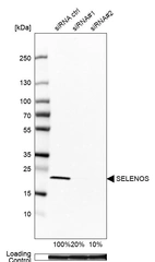 Western blot analysis in U-251MG cells transfected with control siRNA, target specific siRNA probe #1 and #2, using Anti-SELENOS antibody. Remaining relative intensity is presented. Loading control: Anti-GAPDH.