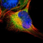 Immunofluorescent staining of human cell line U-251 MG shows localization to endoplasmic reticulum.