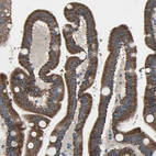Immunohistochemical staining of human Duodenum shows strong granular cytoplasmic positivity in glandular cells.