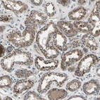 Immunohistochemical staining of human Kidney shows strong granular cytoplasmic positivity in cells in tubules.