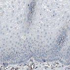 Immunohistochemical staining of human Cervix shows no granular cytoplasmic positivity in squamous epithelial cells.
