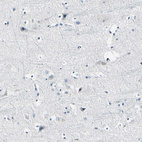 Immunohistochemical staining of human cerebral cortex shows no positivity in neurons.