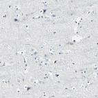 Immunohistochemical staining of human cerebral cortex shows no positivity in neurons.