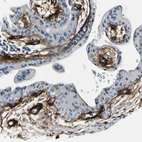 Immunohistochemical staining of human placenta shows moderate cytoplasmic positivity in connective tissues.