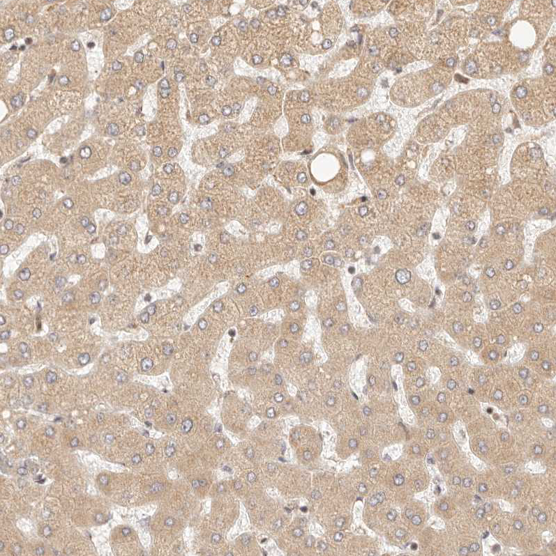 Anti-TIMM17A Antibody