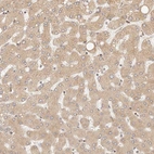 Anti-TIMM17A Antibody