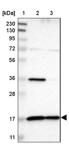 Lane 1: Marker [kDa] 230, 130, 95, 72, 56, 36, 28, 17, 11_br/_Lane 2: Human cell line RT-4_br/_Lane 3: Human cell line U-251MG sp