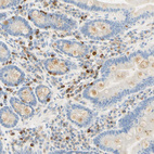 Immunohistochemical staining of human duodenum shows moderate to strong cytoplasmic positivity in lymphoid cells.