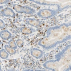Immunohistochemical staining of human duodenum shows moderate to strong cytoplasmic positivity in lymphoid cells.