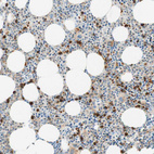 Immunohistochemical staining of human bone marrow shows moderate to strong cytoplasmic positivity in hematopoietic cells.