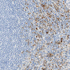 Immunohistochemical staining of human spleen shows moderate to strong cytoplasmic positivity in cells in red pulp.
