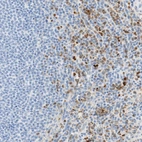Immunohistochemical staining of human spleen shows moderate to strong cytoplasmic positivity in cells in red pulp.
