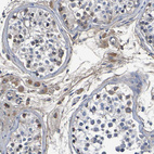Immunohistochemical staining of human testis shows weak cytoplasmic positivity in Leydig cells.