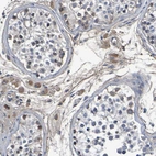 Immunohistochemical staining of human testis shows weak cytoplasmic positivity in Leydig cells.