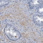 Immunohistochemical staining of human prostate shows weak cytoplasmic positivity in smooth muscle cells.